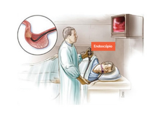 Endoscopia Digestiva Alta