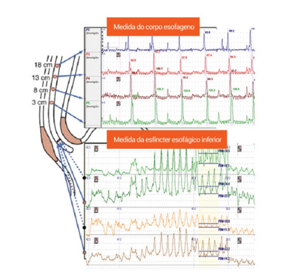 Manometria esofágica e anorretal